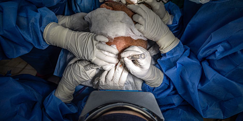 Hair Transplant