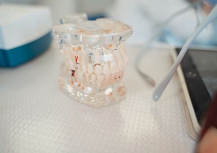 implantes dentales precio