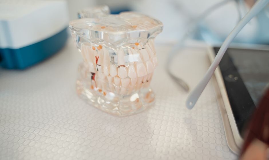 implantes dentales precio