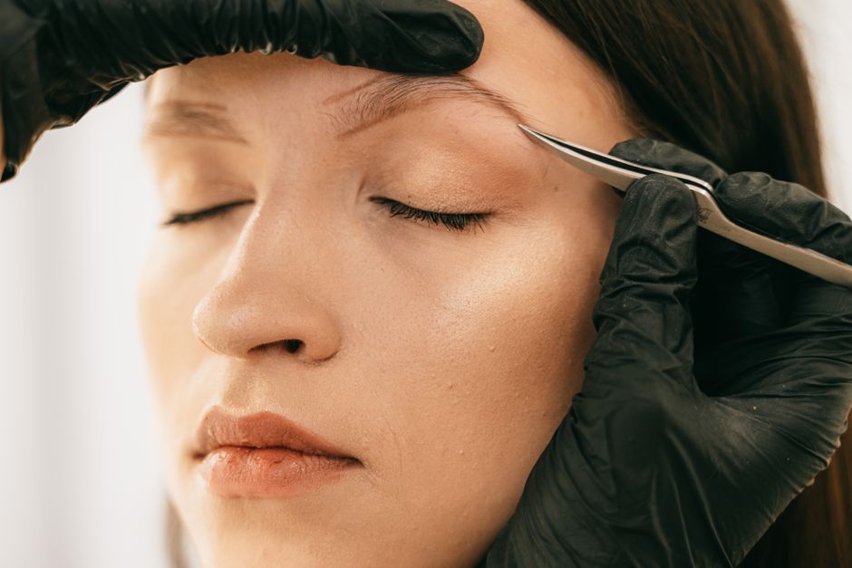 eliminación tatuaje láser